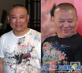 郭德纲露爱马仕腰带再炫富 网友 闪瞎你的眼